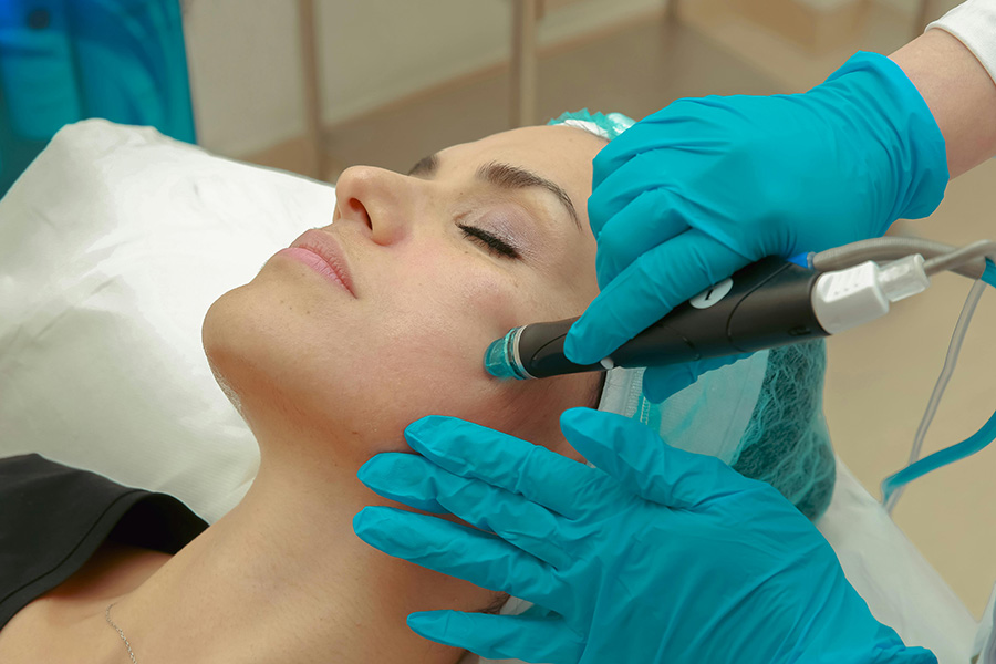 RF-Microneedling RF Microneedling