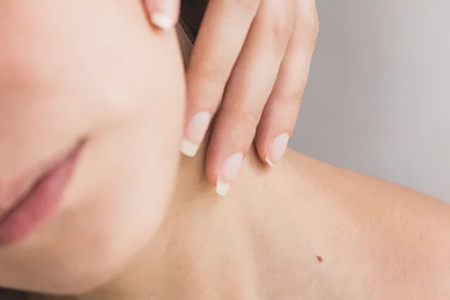 Vampire-Facial-with-RF-Microneedling Vampire Facial with RF Microneedling